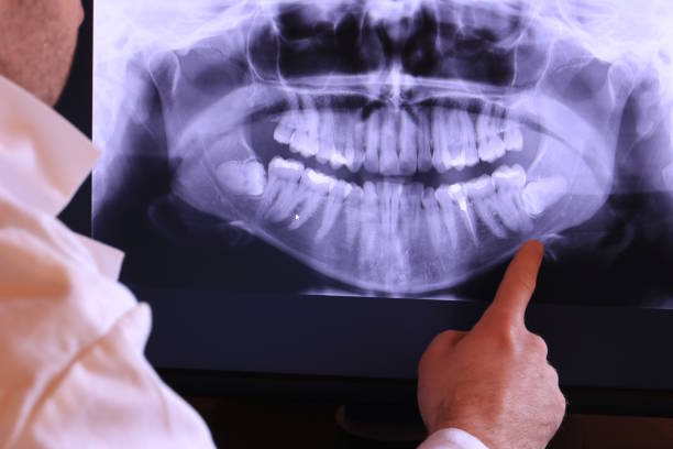 Best Urgent Tooth Repair  in Lemont Furnace, PA